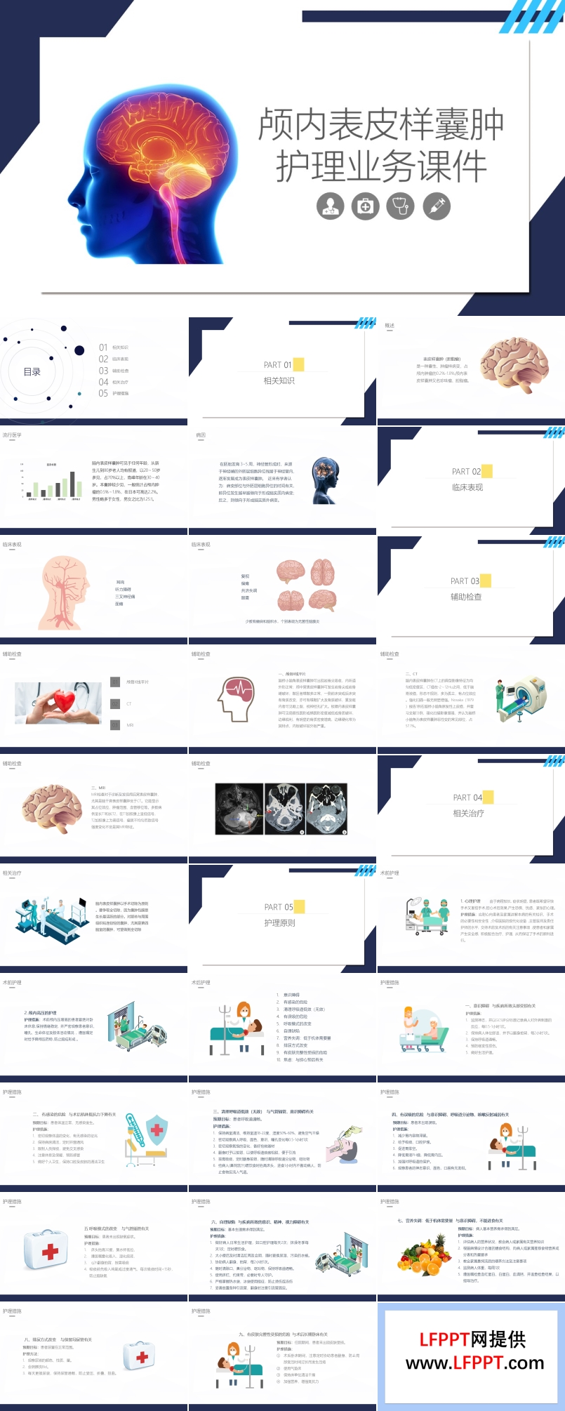 顱內(nèi)表皮樣囊腫護(hù)理課件PPT