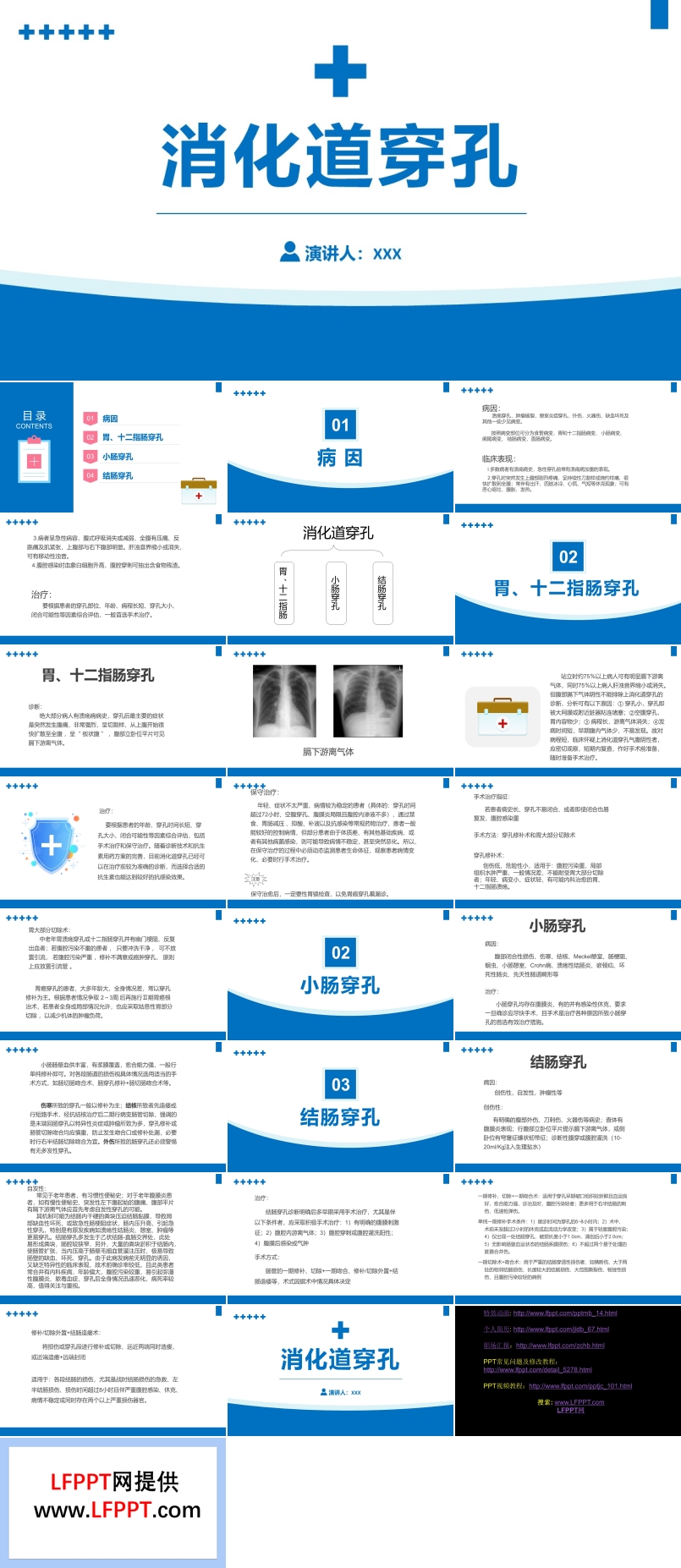 消化道穿孔醫(yī)療課件知識PPT